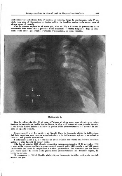 Rivista di patologia e clinica della tubercolosi organo ufficiale della Società italiana fascista di studi scientifici sulla tubercolosi