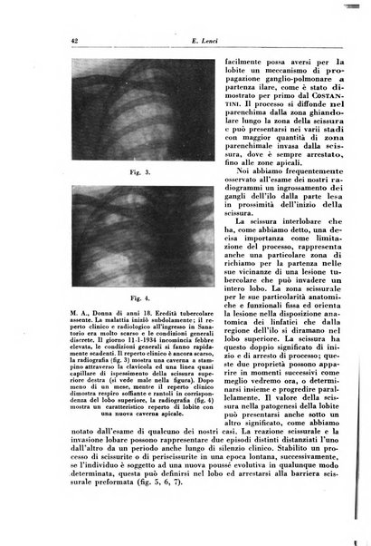 Rivista di patologia e clinica della tubercolosi organo ufficiale della Società italiana fascista di studi scientifici sulla tubercolosi