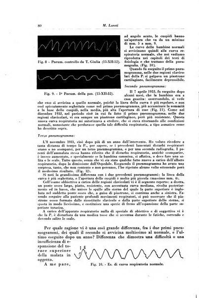 Rivista di patologia e clinica della tubercolosi organo ufficiale della Società italiana fascista di studi scientifici sulla tubercolosi