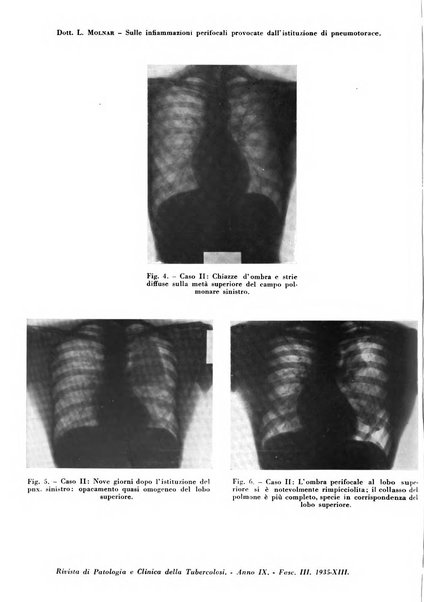 Rivista di patologia e clinica della tubercolosi organo ufficiale della Società italiana fascista di studi scientifici sulla tubercolosi