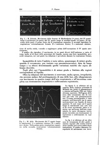 Rivista di patologia e clinica della tubercolosi organo ufficiale della Società italiana fascista di studi scientifici sulla tubercolosi