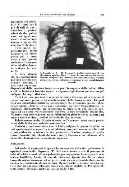 Rivista di patologia e clinica della tubercolosi organo ufficiale della Società italiana fascista di studi scientifici sulla tubercolosi