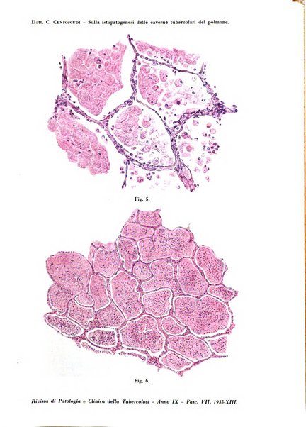 Rivista di patologia e clinica della tubercolosi organo ufficiale della Società italiana fascista di studi scientifici sulla tubercolosi