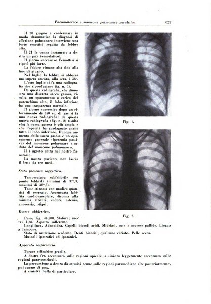 Rivista di patologia e clinica della tubercolosi organo ufficiale della Società italiana fascista di studi scientifici sulla tubercolosi