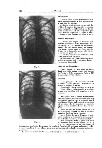 Rivista di patologia e clinica della tubercolosi organo ufficiale della Società italiana fascista di studi scientifici sulla tubercolosi