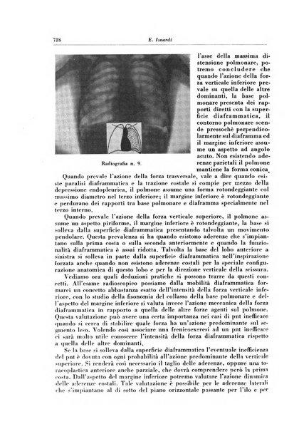 Rivista di patologia e clinica della tubercolosi organo ufficiale della Società italiana fascista di studi scientifici sulla tubercolosi