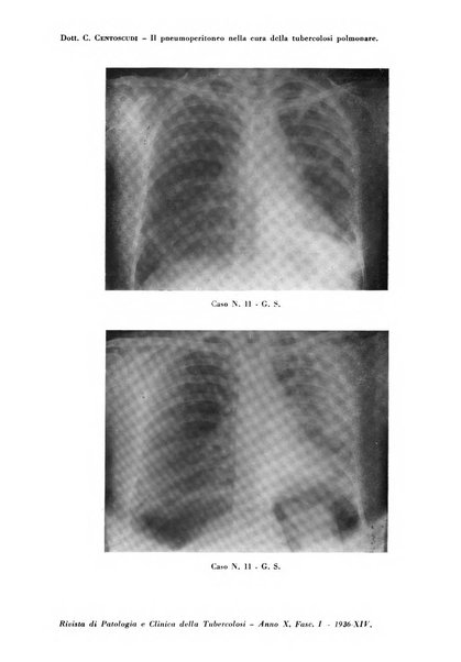 Rivista di patologia e clinica della tubercolosi organo ufficiale della Società italiana fascista di studi scientifici sulla tubercolosi