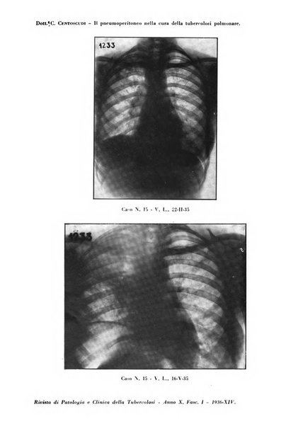 Rivista di patologia e clinica della tubercolosi organo ufficiale della Società italiana fascista di studi scientifici sulla tubercolosi