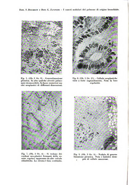 Rivista di patologia e clinica della tubercolosi organo ufficiale della Società italiana fascista di studi scientifici sulla tubercolosi