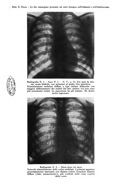 Rivista di patologia e clinica della tubercolosi organo ufficiale della Società italiana fascista di studi scientifici sulla tubercolosi