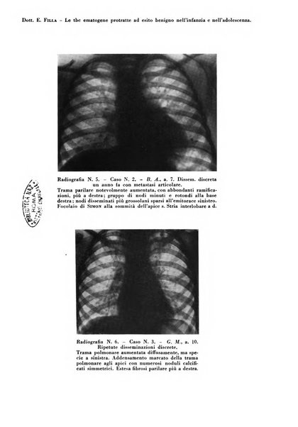 Rivista di patologia e clinica della tubercolosi organo ufficiale della Società italiana fascista di studi scientifici sulla tubercolosi