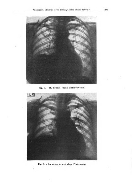 Rivista di patologia e clinica della tubercolosi organo ufficiale della Società italiana fascista di studi scientifici sulla tubercolosi