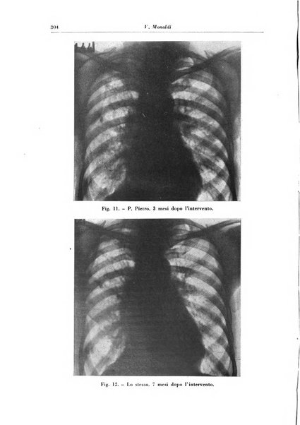 Rivista di patologia e clinica della tubercolosi organo ufficiale della Società italiana fascista di studi scientifici sulla tubercolosi