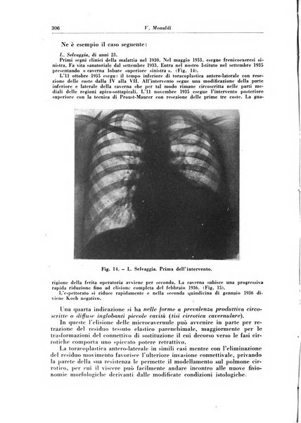 Rivista di patologia e clinica della tubercolosi organo ufficiale della Società italiana fascista di studi scientifici sulla tubercolosi