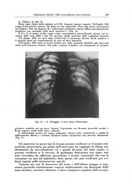 Rivista di patologia e clinica della tubercolosi organo ufficiale della Società italiana fascista di studi scientifici sulla tubercolosi