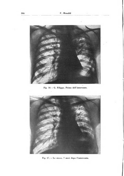 Rivista di patologia e clinica della tubercolosi organo ufficiale della Società italiana fascista di studi scientifici sulla tubercolosi