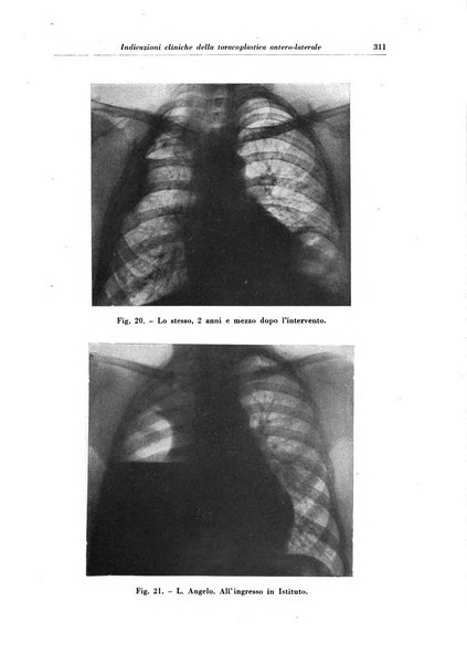 Rivista di patologia e clinica della tubercolosi organo ufficiale della Società italiana fascista di studi scientifici sulla tubercolosi