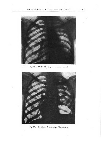 Rivista di patologia e clinica della tubercolosi organo ufficiale della Società italiana fascista di studi scientifici sulla tubercolosi