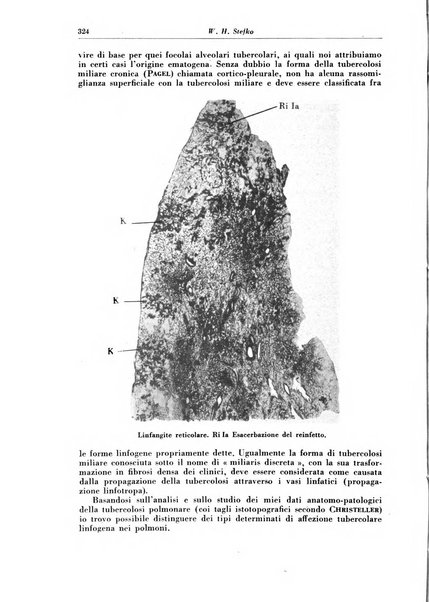 Rivista di patologia e clinica della tubercolosi organo ufficiale della Società italiana fascista di studi scientifici sulla tubercolosi