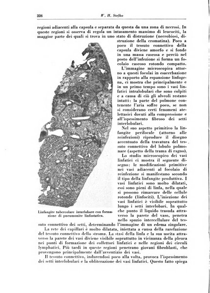 Rivista di patologia e clinica della tubercolosi organo ufficiale della Società italiana fascista di studi scientifici sulla tubercolosi