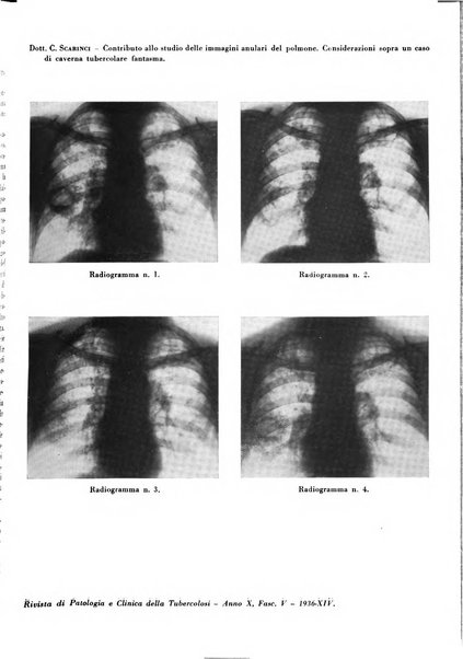 Rivista di patologia e clinica della tubercolosi organo ufficiale della Società italiana fascista di studi scientifici sulla tubercolosi