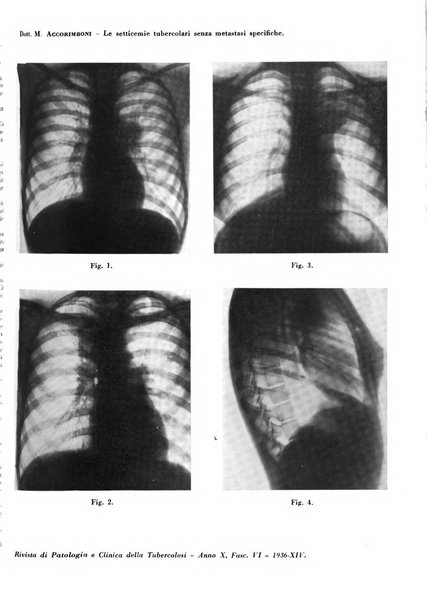 Rivista di patologia e clinica della tubercolosi organo ufficiale della Società italiana fascista di studi scientifici sulla tubercolosi