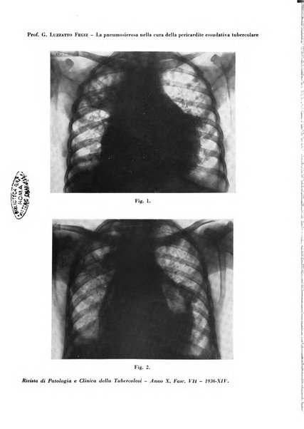 Rivista di patologia e clinica della tubercolosi organo ufficiale della Società italiana fascista di studi scientifici sulla tubercolosi