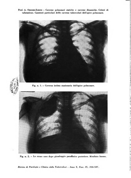 Rivista di patologia e clinica della tubercolosi organo ufficiale della Società italiana fascista di studi scientifici sulla tubercolosi