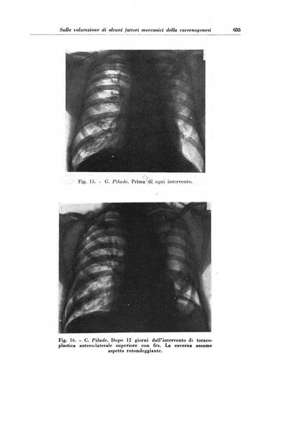 Rivista di patologia e clinica della tubercolosi organo ufficiale della Società italiana fascista di studi scientifici sulla tubercolosi