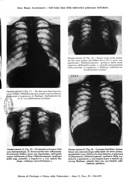 Rivista di patologia e clinica della tubercolosi organo ufficiale della Società italiana fascista di studi scientifici sulla tubercolosi