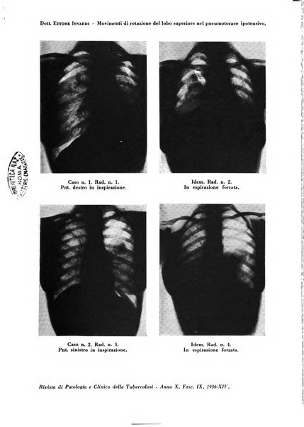 Rivista di patologia e clinica della tubercolosi organo ufficiale della Società italiana fascista di studi scientifici sulla tubercolosi