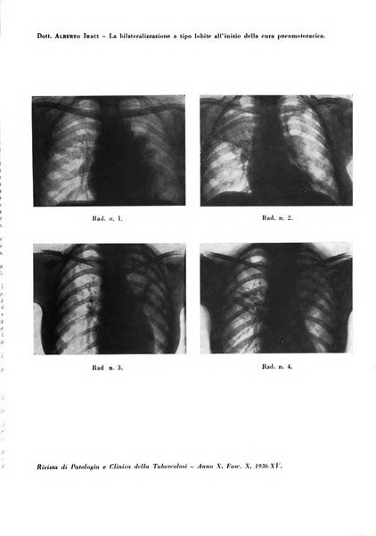 Rivista di patologia e clinica della tubercolosi organo ufficiale della Società italiana fascista di studi scientifici sulla tubercolosi