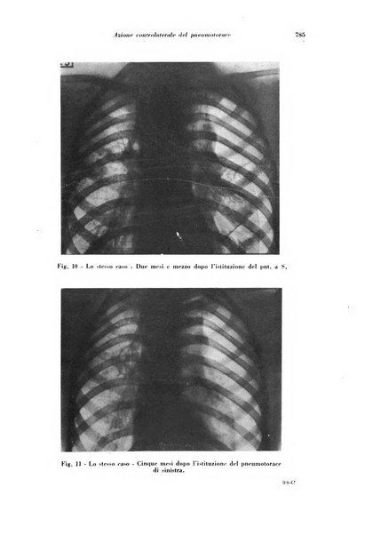 Rivista di patologia e clinica della tubercolosi organo ufficiale della Società italiana fascista di studi scientifici sulla tubercolosi