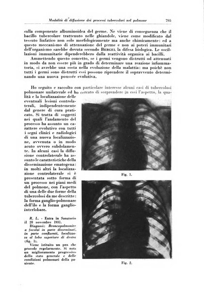 Rivista di patologia e clinica della tubercolosi organo ufficiale della Società italiana fascista di studi scientifici sulla tubercolosi