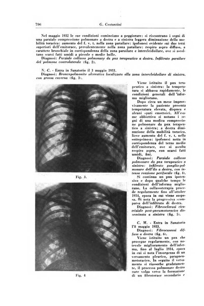 Rivista di patologia e clinica della tubercolosi organo ufficiale della Società italiana fascista di studi scientifici sulla tubercolosi