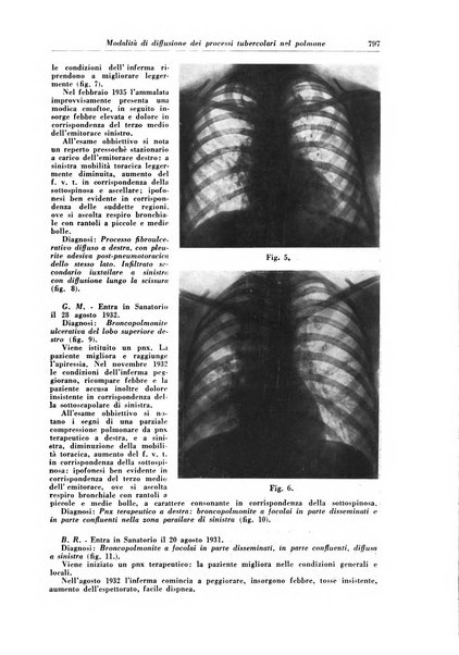 Rivista di patologia e clinica della tubercolosi organo ufficiale della Società italiana fascista di studi scientifici sulla tubercolosi