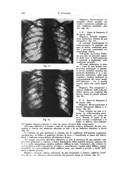 Rivista di patologia e clinica della tubercolosi organo ufficiale della Società italiana fascista di studi scientifici sulla tubercolosi