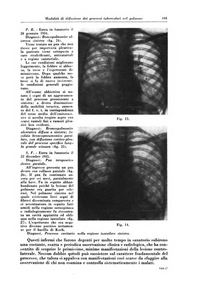 Rivista di patologia e clinica della tubercolosi organo ufficiale della Società italiana fascista di studi scientifici sulla tubercolosi