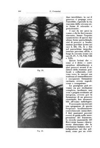 Rivista di patologia e clinica della tubercolosi organo ufficiale della Società italiana fascista di studi scientifici sulla tubercolosi