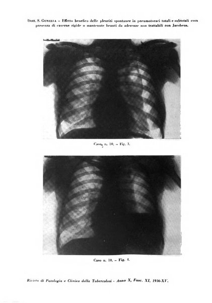 Rivista di patologia e clinica della tubercolosi organo ufficiale della Società italiana fascista di studi scientifici sulla tubercolosi