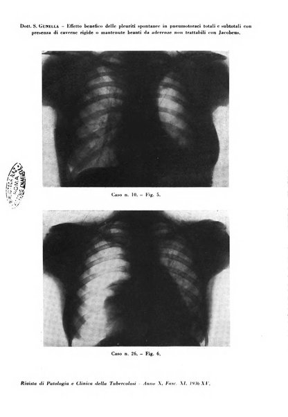 Rivista di patologia e clinica della tubercolosi organo ufficiale della Società italiana fascista di studi scientifici sulla tubercolosi