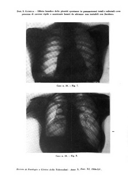 Rivista di patologia e clinica della tubercolosi organo ufficiale della Società italiana fascista di studi scientifici sulla tubercolosi