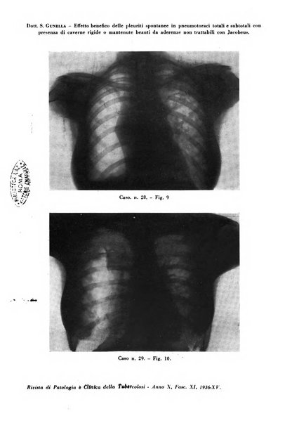 Rivista di patologia e clinica della tubercolosi organo ufficiale della Società italiana fascista di studi scientifici sulla tubercolosi