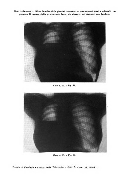 Rivista di patologia e clinica della tubercolosi organo ufficiale della Società italiana fascista di studi scientifici sulla tubercolosi