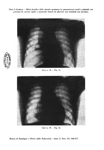 Rivista di patologia e clinica della tubercolosi organo ufficiale della Società italiana fascista di studi scientifici sulla tubercolosi