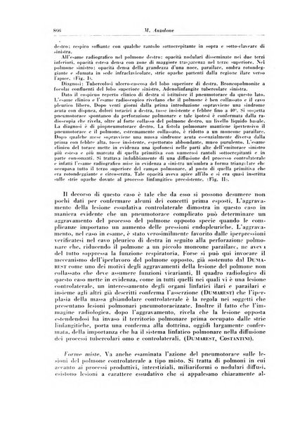 Rivista di patologia e clinica della tubercolosi organo ufficiale della Società italiana fascista di studi scientifici sulla tubercolosi