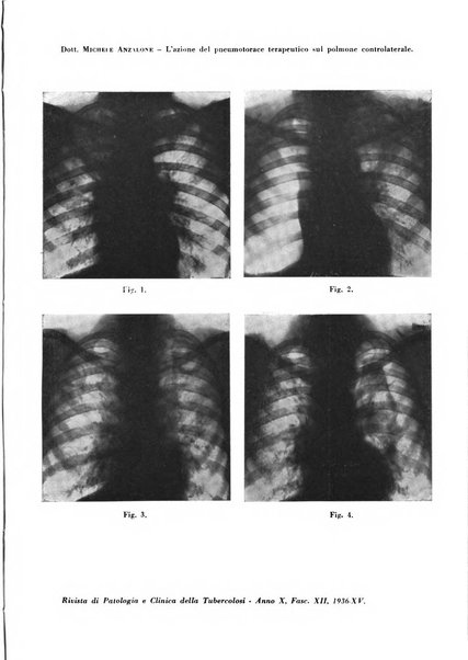 Rivista di patologia e clinica della tubercolosi organo ufficiale della Società italiana fascista di studi scientifici sulla tubercolosi