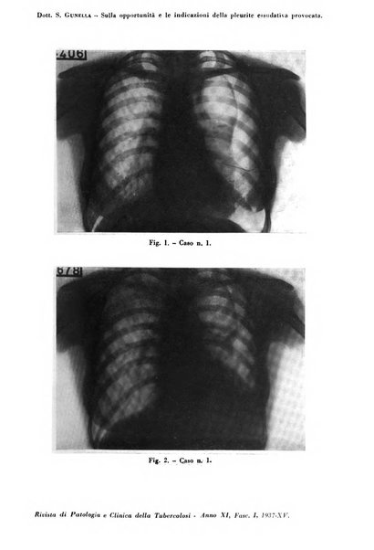 Rivista di patologia e clinica della tubercolosi organo ufficiale della Società italiana fascista di studi scientifici sulla tubercolosi