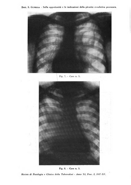 Rivista di patologia e clinica della tubercolosi organo ufficiale della Società italiana fascista di studi scientifici sulla tubercolosi