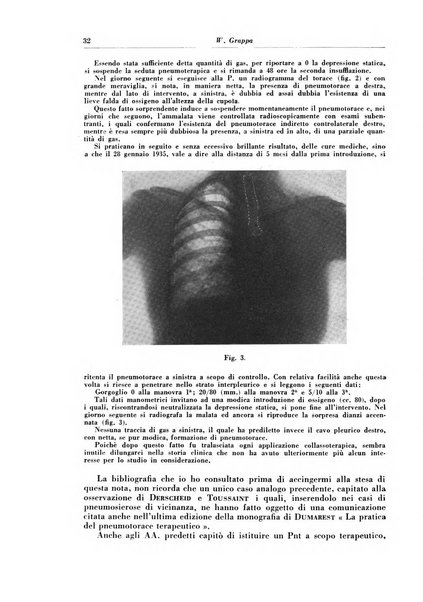 Rivista di patologia e clinica della tubercolosi organo ufficiale della Società italiana fascista di studi scientifici sulla tubercolosi